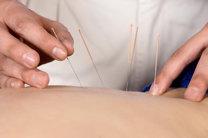 Acupuncture  Mint Hill, NC